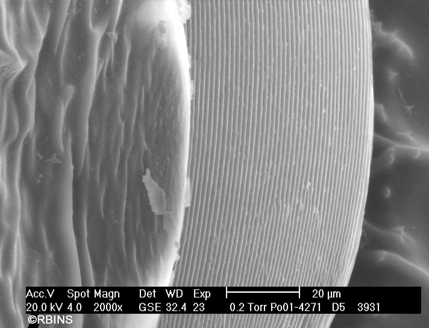 26123_4271_PO171-D5.JPG  Presclerite (pretergite)  Dorsal view